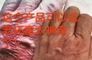 服用张氏雪必康精品案例